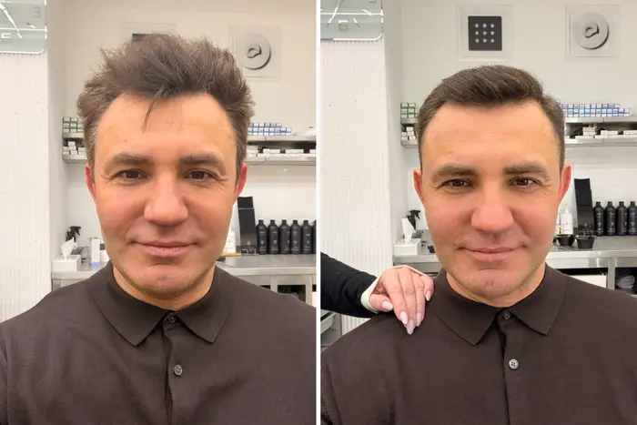 Нардеп Тищенко показав, що трапилося з ним після відвідин салону краси