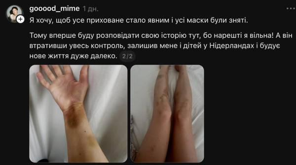 Дружина ведучого розповіла про домашнє насильство 8